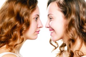 57193748 - portrait of a young woman, before and after rhinoplasty