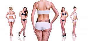 42597749 - woman's buttocks prepared to plastic surgery isolated