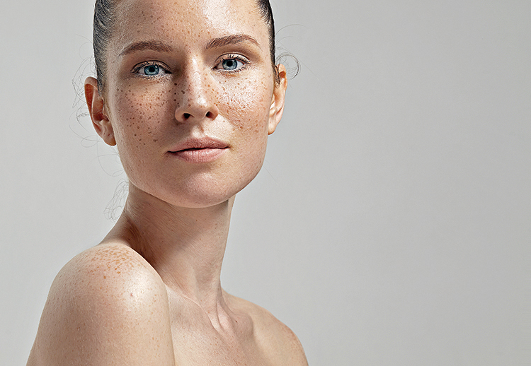 freckles woman's face portrait with healthy skin